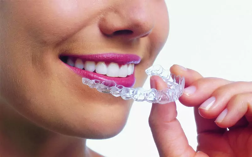 Improve Your Oral Health with Invisalign Treatment