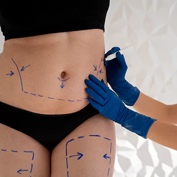 Beyond the Fat: Achieving Aesthetic Transformations with Advanced Liposuction Techniques